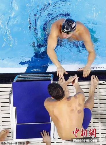 　游泳运动员带着罐印出现在里约奥运会的赛场上